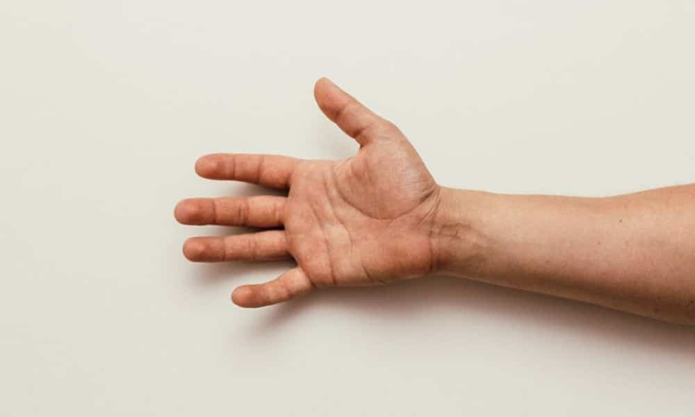 How to Test Trigger Finger Before Trigger Finger Treatment?